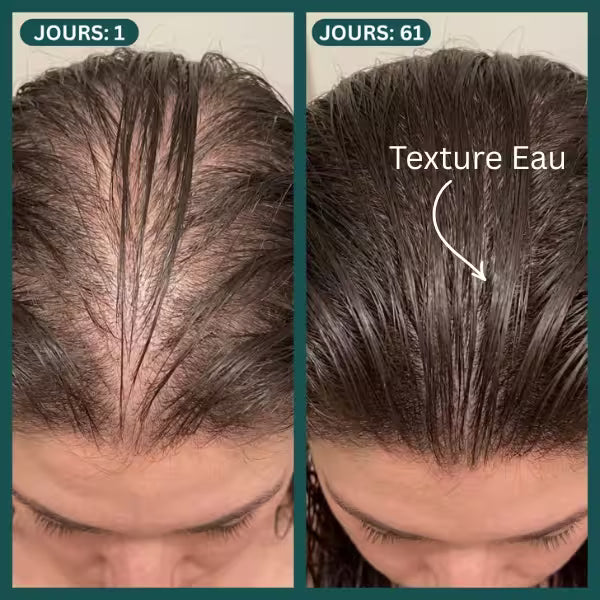 Image of Protocole Activation Marine™ : Traitement Anti-Chute & Densité-1