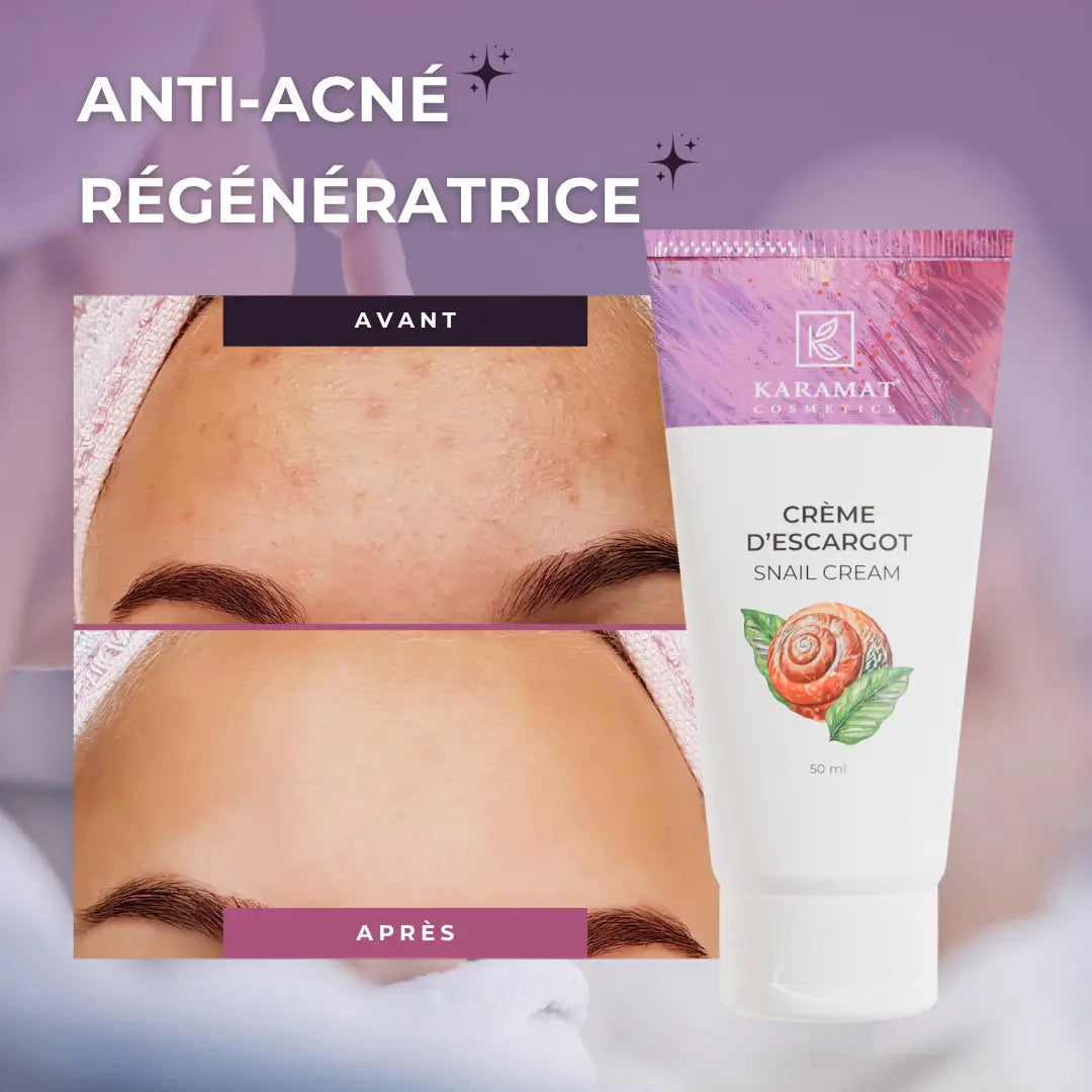 Image of Crème Bave d’Escargot Magique Karamat Cosmetics 50 ml-2