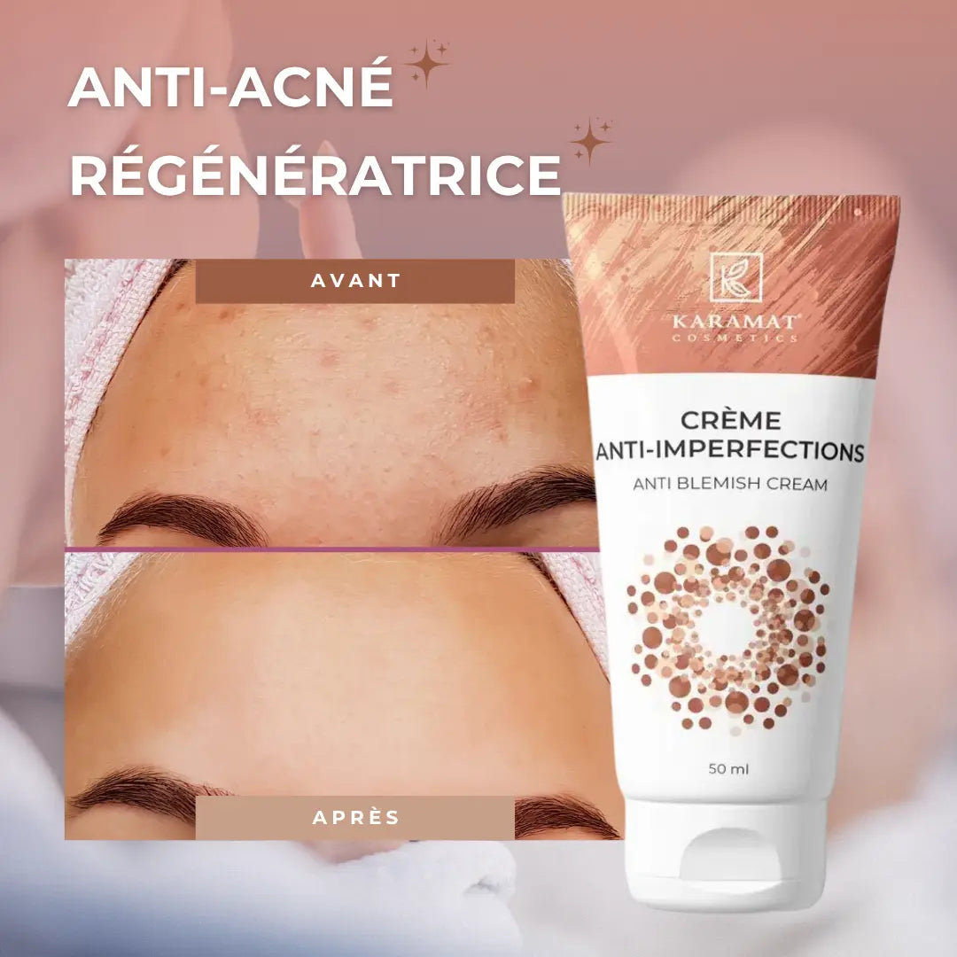 Image of Crème anti-imperfections 50 ml-2