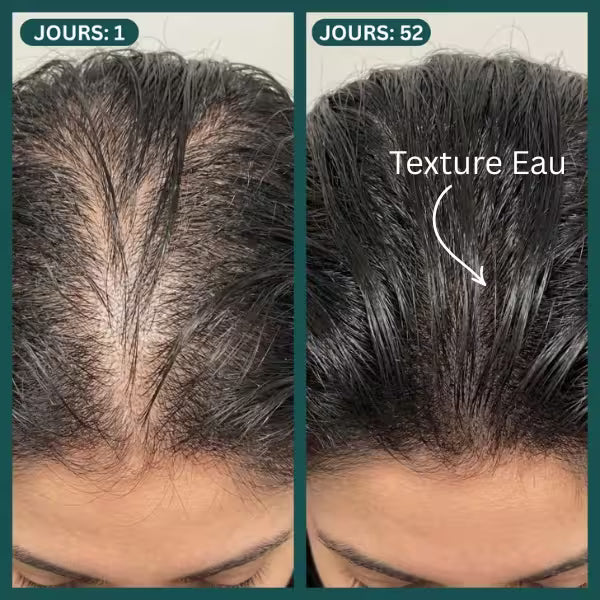 Image of Protocole Activation Marine™ : Traitement Anti-Chute & Densité-4
