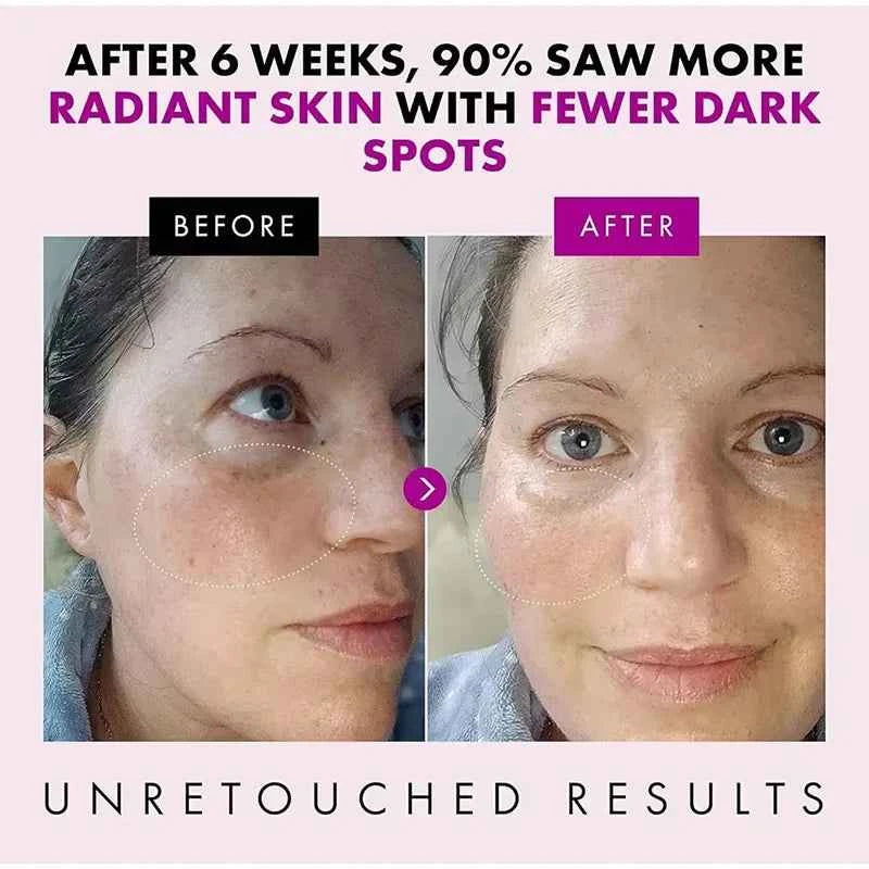Image of Koreanische Kollagen Straffende Anti-Falten-Gesichtscreme, verblasst feine Linien, Lifting, Anti-Aging, tiefe Feuchtigkeit, Aufhellung, Hautpflegecreme, 50 g