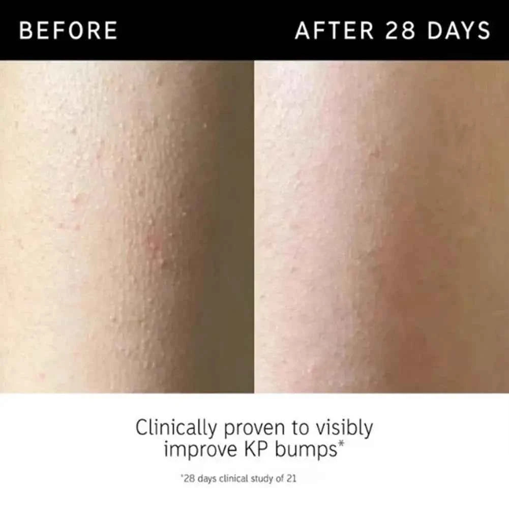Image of Koreanische Tiefenreinigung Peeling Gel Entfernen Mitesser Schrumpfen Poren Bleichen Feuchtigkeitsspendende Sanfte Gesichts Hautpflege Peeling Creme