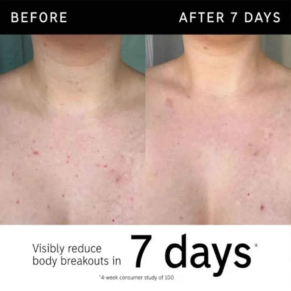 Image of Koreanische Tiefenreinigung Peeling Gel Entfernen Mitesser Schrumpfen Poren Bleichen Feuchtigkeitsspendende Sanfte Gesichts Hautpflege Peeling Creme