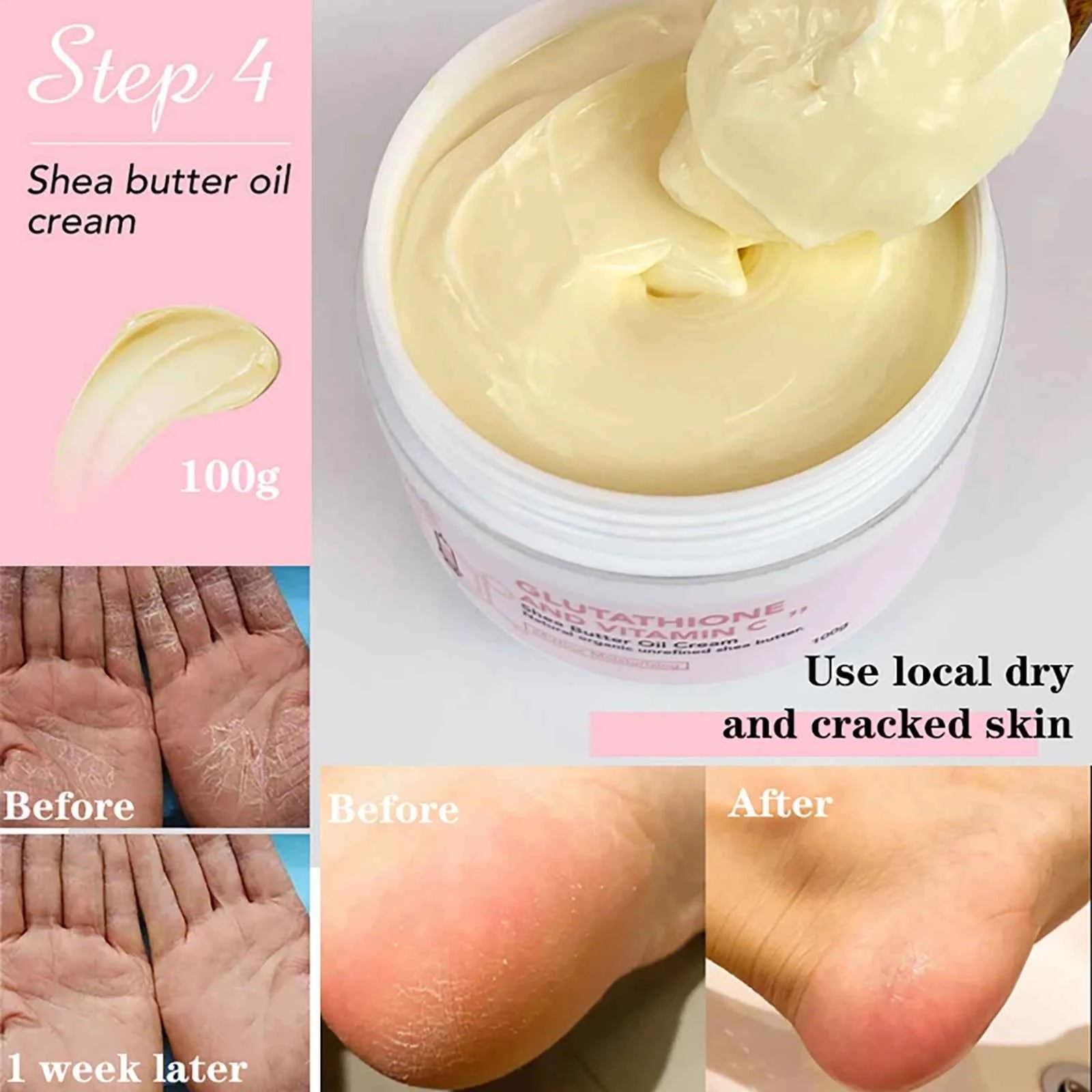 Image of AILKE Whitening Feuchtigkeitsspendende koreanische Gesichts- und Körperlotion, reduziert Melaninfalten, Vitamin C dunkle Flecken, entfernt Hautpflegecreme