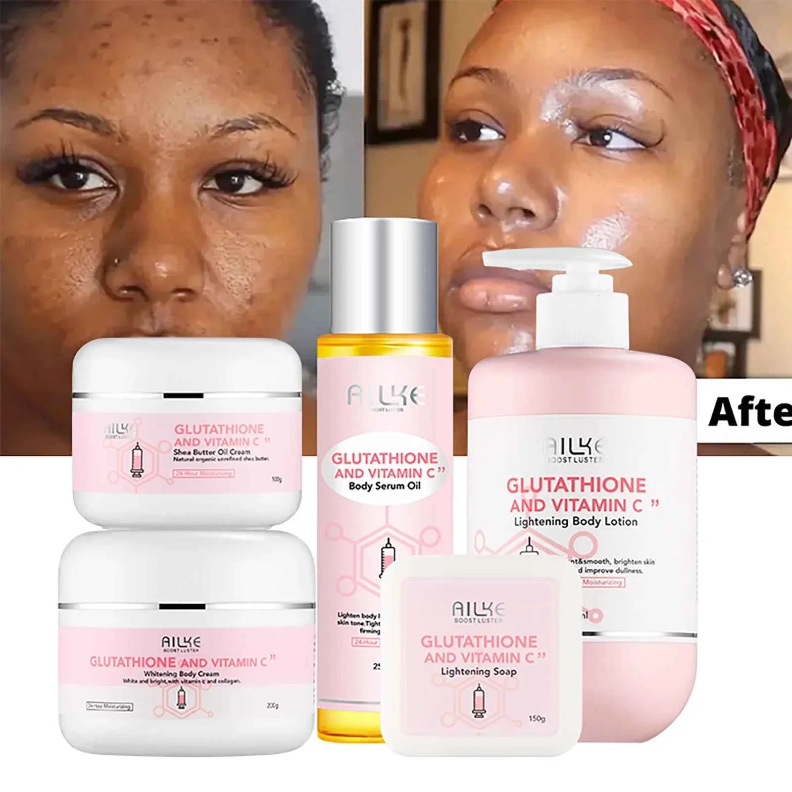Image of AILKE Whitening Feuchtigkeitsspendende koreanische Gesichts- und Körperlotion, reduziert Melaninfalten, Vitamin C dunkle Flecken, entfernt Hautpflegecreme