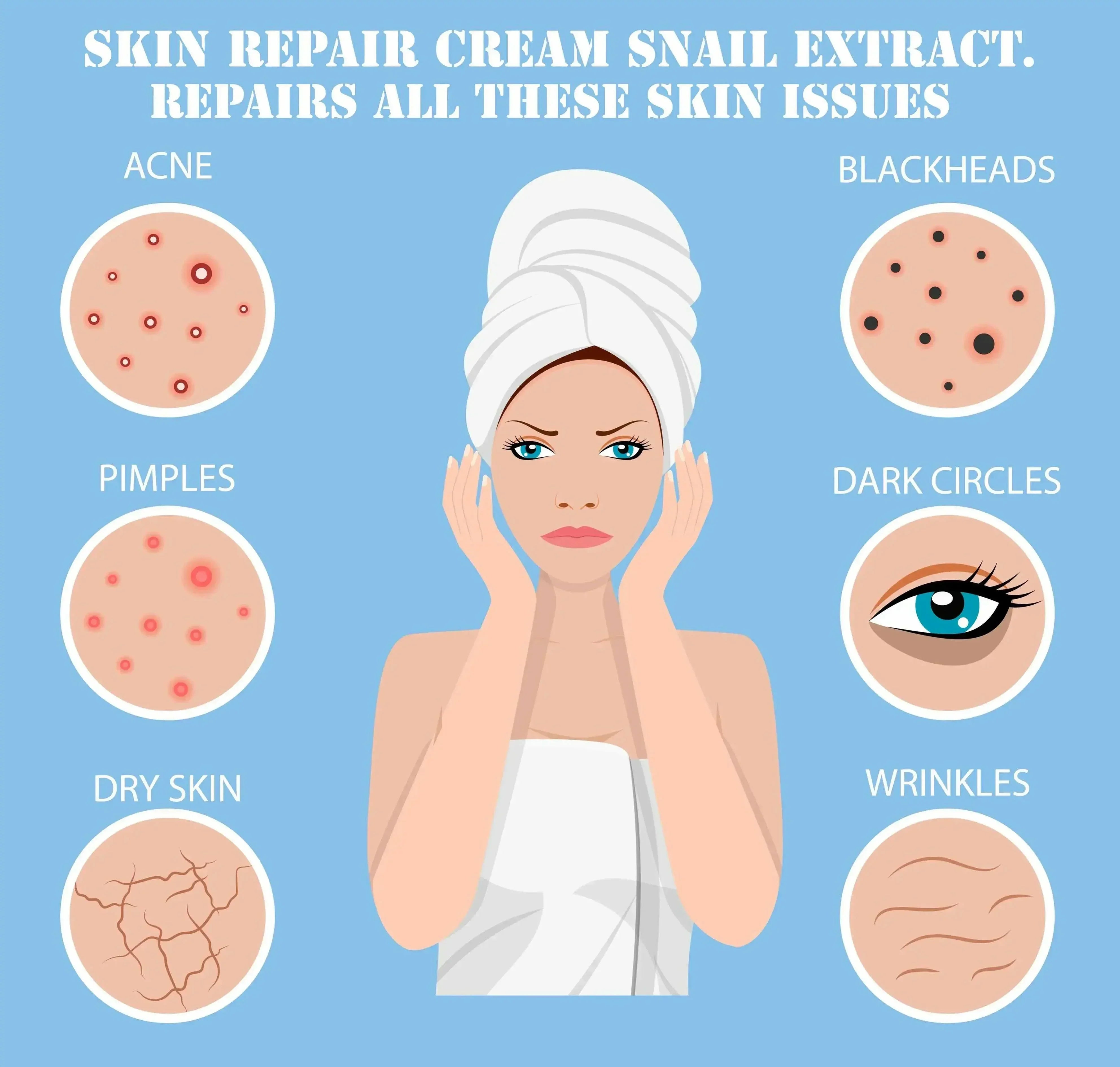 Image of Ammuri Snail Extract Skin Cream for Deep Repair-1