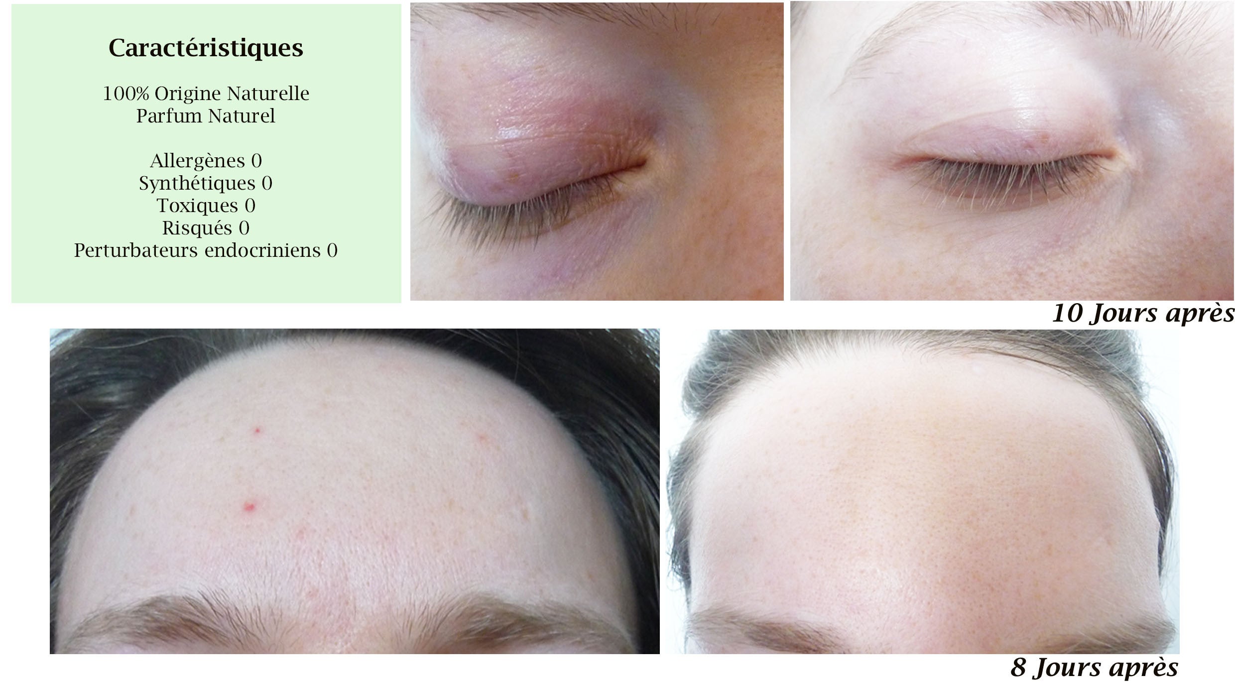 Image of MERVEILLE DES LANDES ORGANIC - Sensitive Skin Care Complete Regeneration Face-10