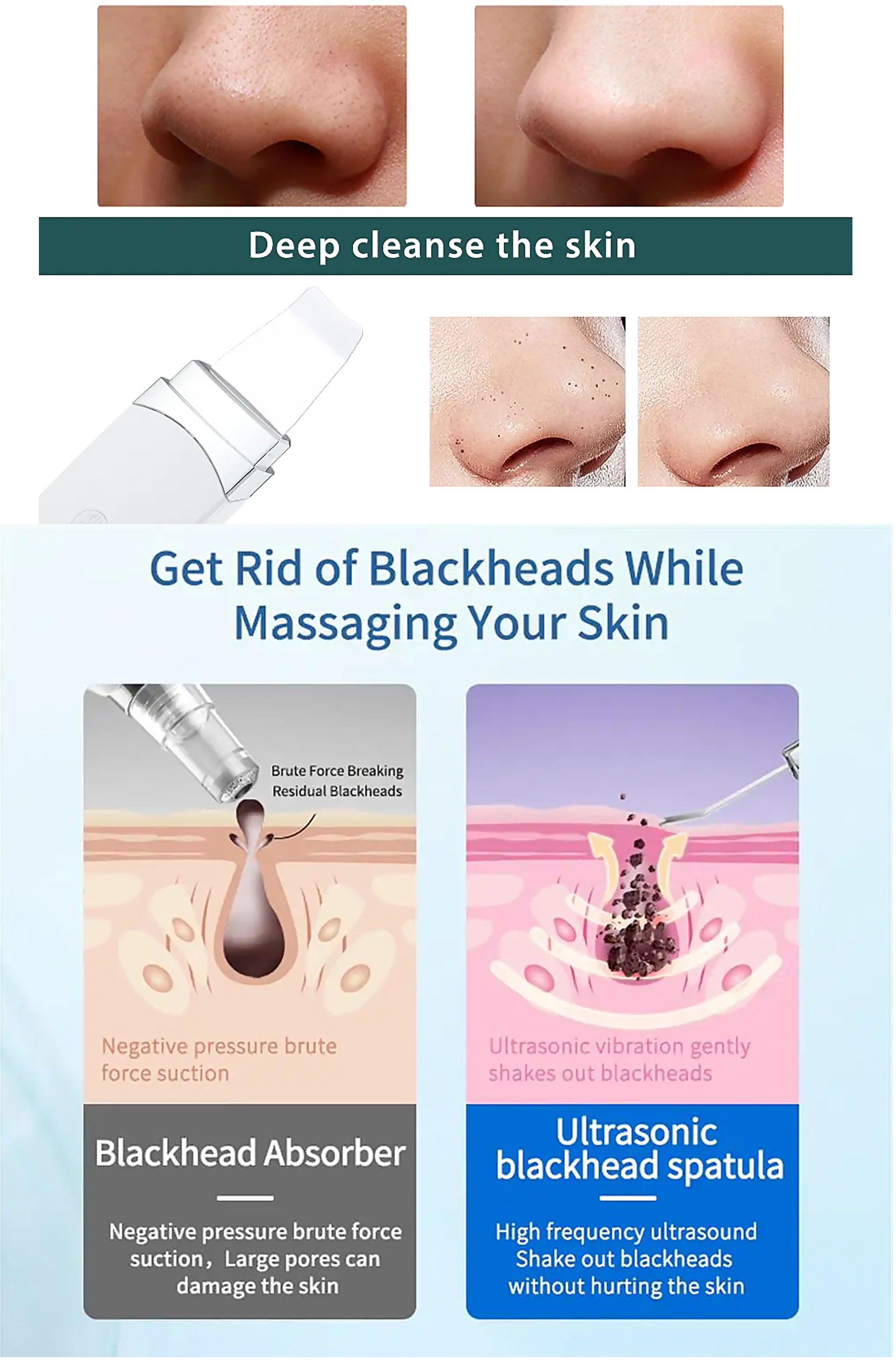 Image of KALICY - Triple Function Lifting Exfoliator - Ultrasonic Treatment-8