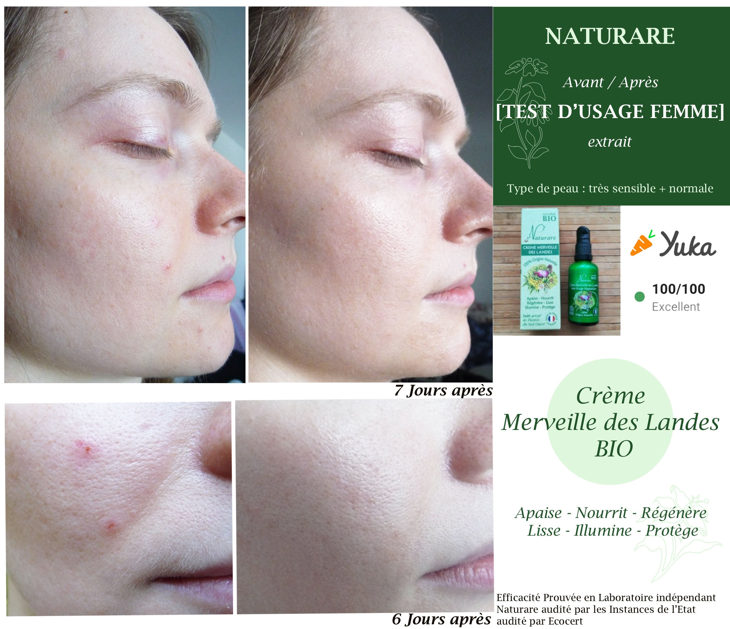 Image of DROP - MERVEILLE DES LANDES ORGANIC - Sensitive Skin Care Complete Regeneration-9