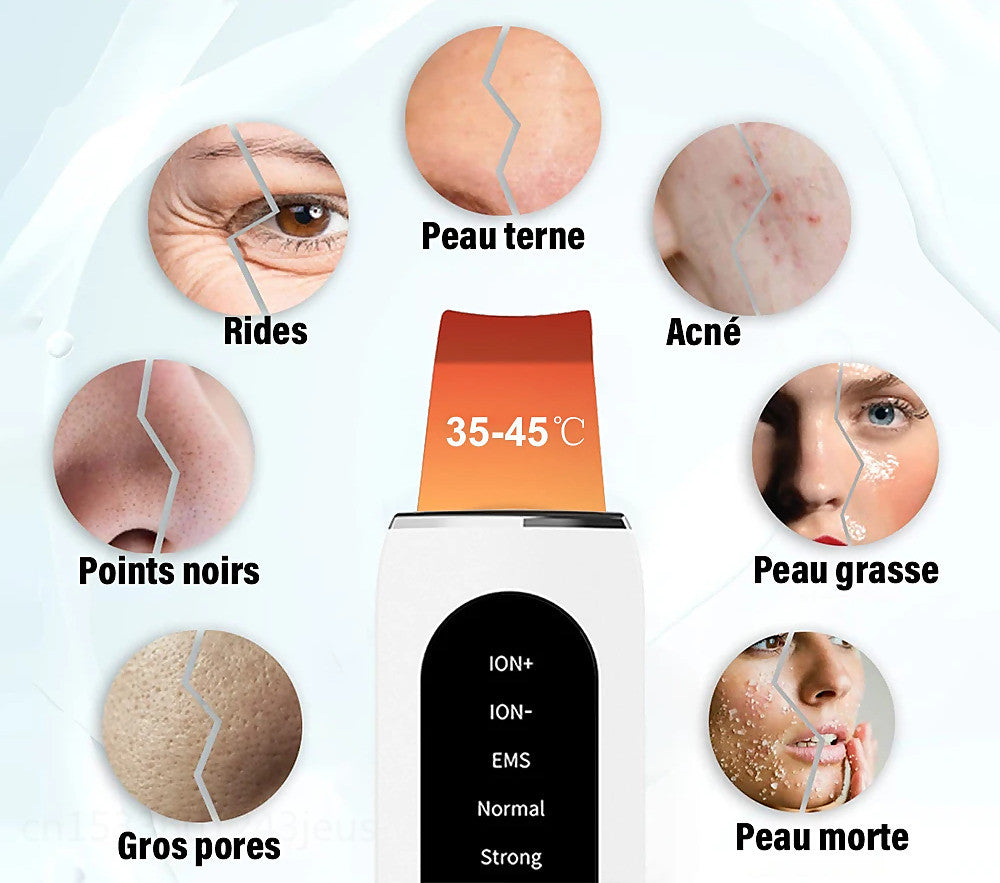 Image of STELLAR - 5-Function EMS Lifting Exfoliator - Ultrasound & Photon Treatment-3