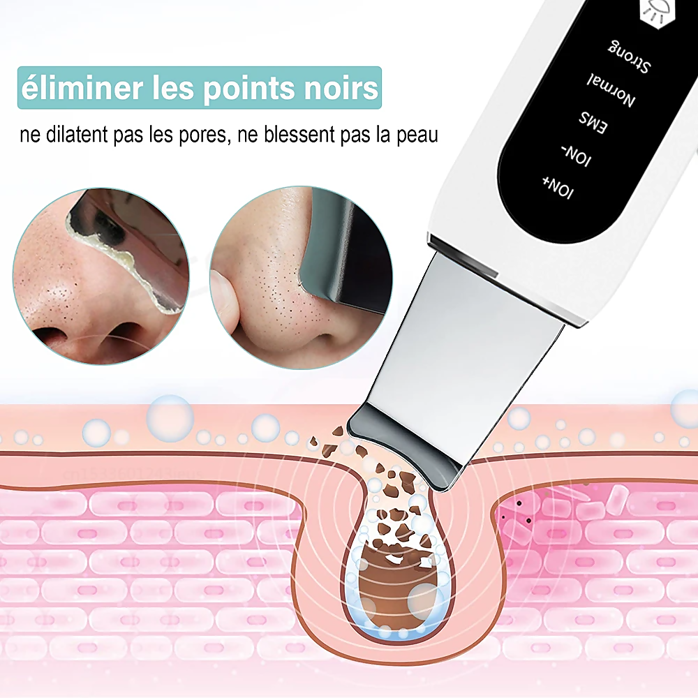 Image of STELLAR - 5-Function EMS Lifting Exfoliator - Ultrasound & Photon Treatment-8
