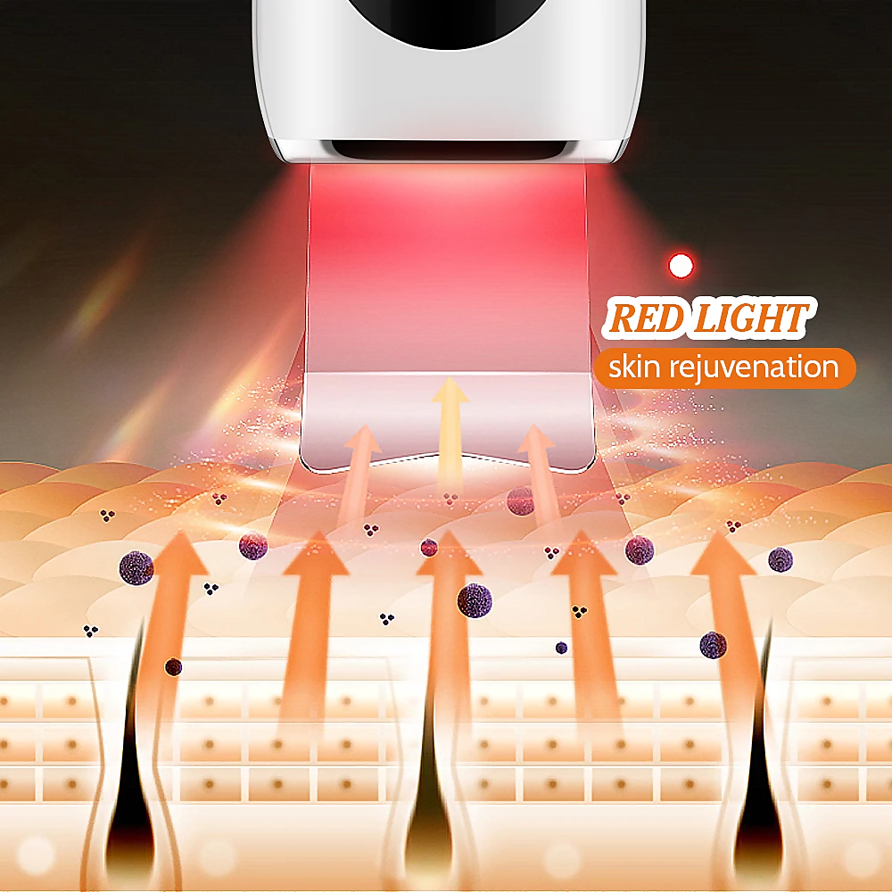 Image of STELLAR - 5-Function EMS Lifting Exfoliator - Ultrasound & Photon Treatment-5