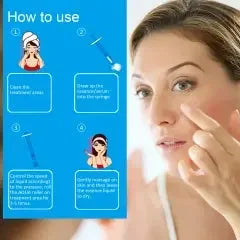 Image of Ammuri Beauty Microneedling Serum Roller for Youthful Skin-1
